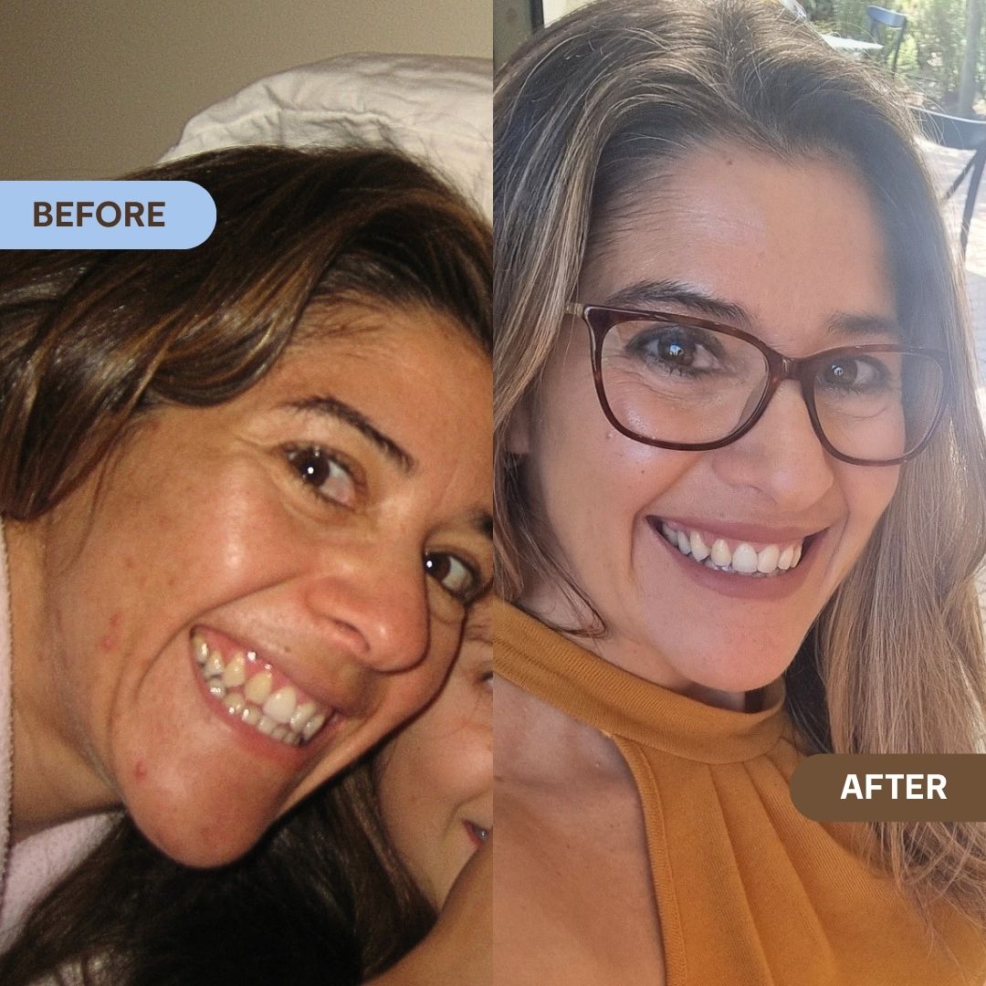 Nourishing Night Cream - Beeautify