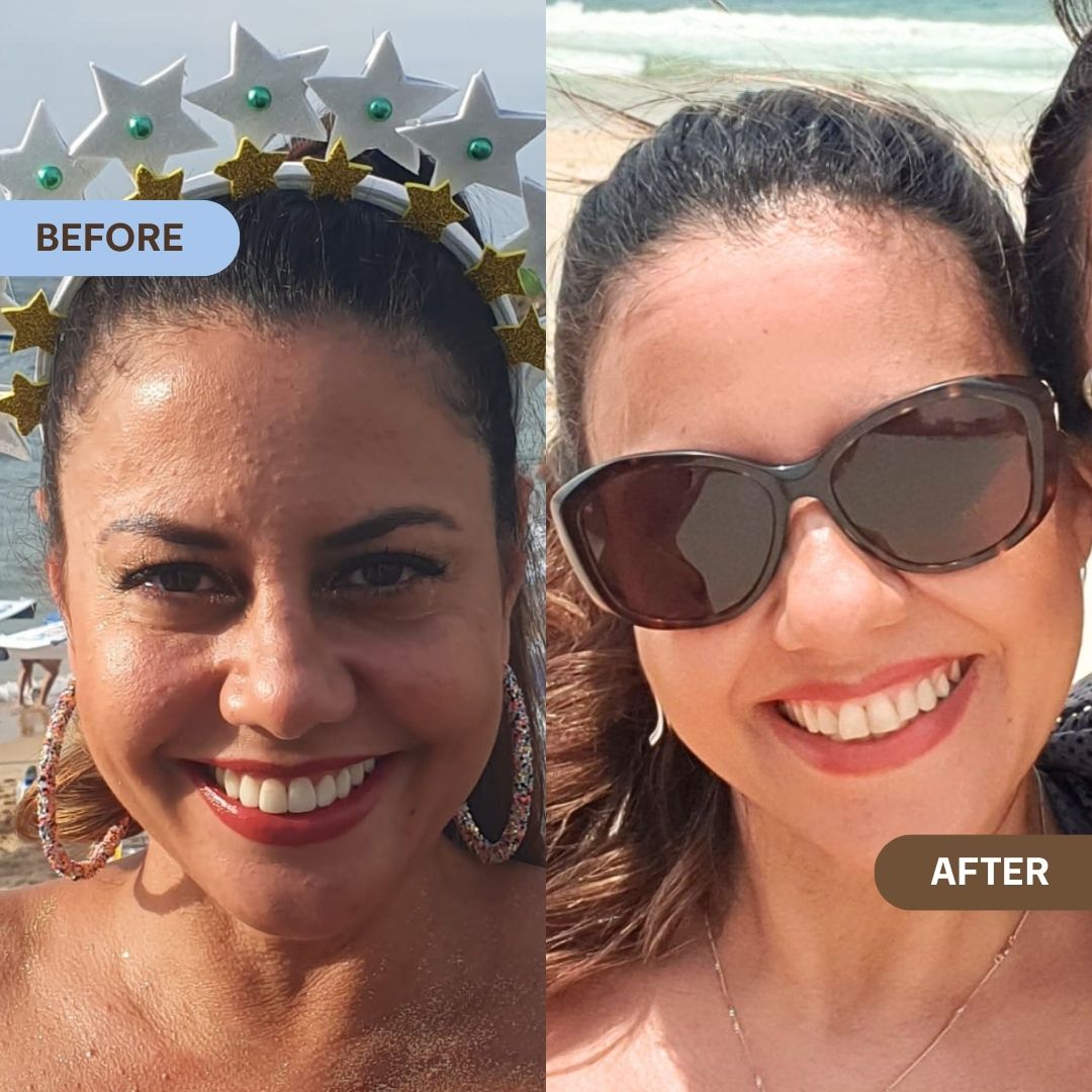 Balancing Skincare Routine